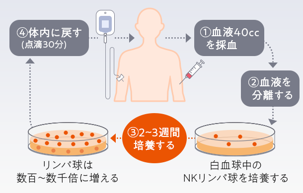 NK活性療法/ANK免疫細胞療法